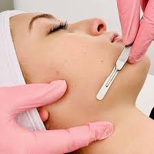 Tratamiento de Dermaplaning - Eugenia Style Estética